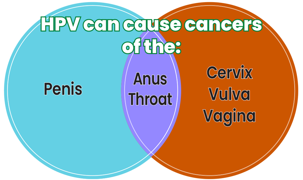 Venn diagram showing that HPV can cause cancers of the penis, anus, throat, cervix, vulva, and vagina