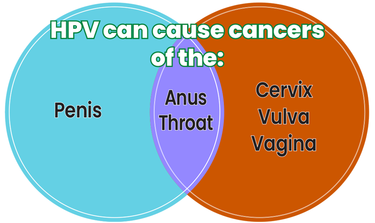 Venn diagram showing that HPV can cause cancers of the penis, anus, throat, cervix, vulva, and vagina